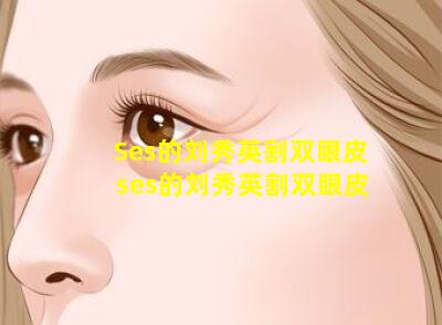 Ses的刘秀英割双眼皮 ses的刘秀英割双眼皮